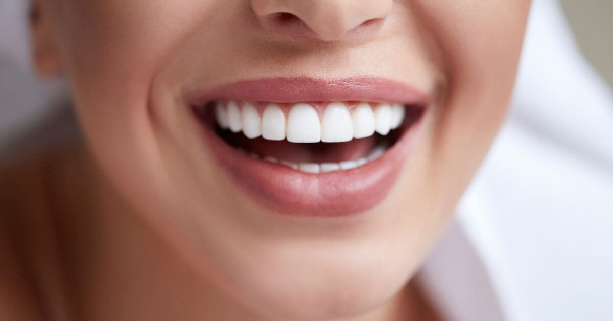 Natural Way To Make Brighter Teeth And Healthy